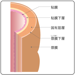 図２　大腸の壁の構造の図