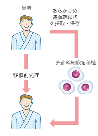 図２　自家造血幹細胞移植（自家移植）