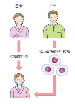 図３　同種造血幹細胞移植（同種移植）