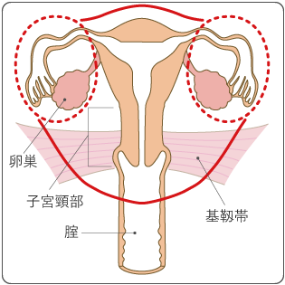 図８　広汎子宮全摘出術の範囲の図