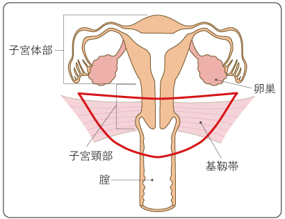 図９　広汎子宮頸部摘出術の範囲の図