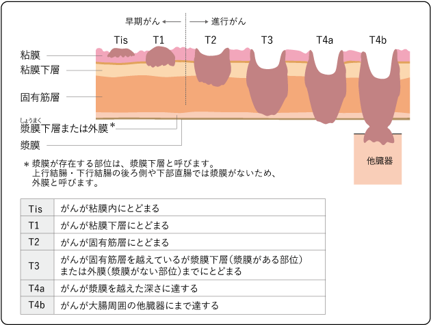  IBSの症状