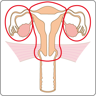 図５　準広汎子宮全摘出術と両側付属器摘出術の範囲の図
