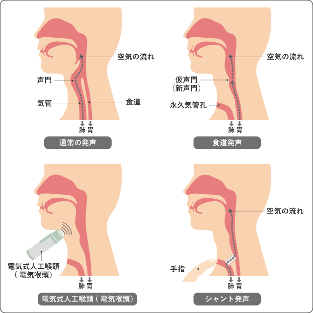 図８　発声法の種類