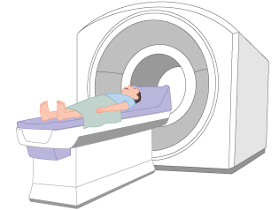 MRI検査 イメージ図