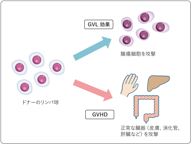 図２　GVHDとGVL効果