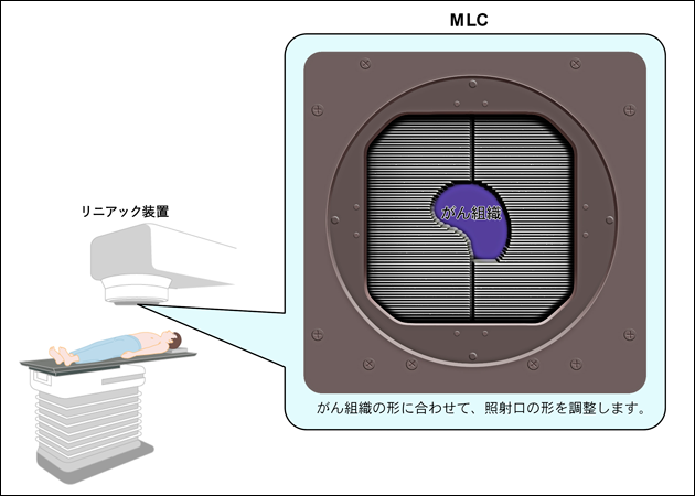図２　マルチリーフコリメーター（MLC）の図