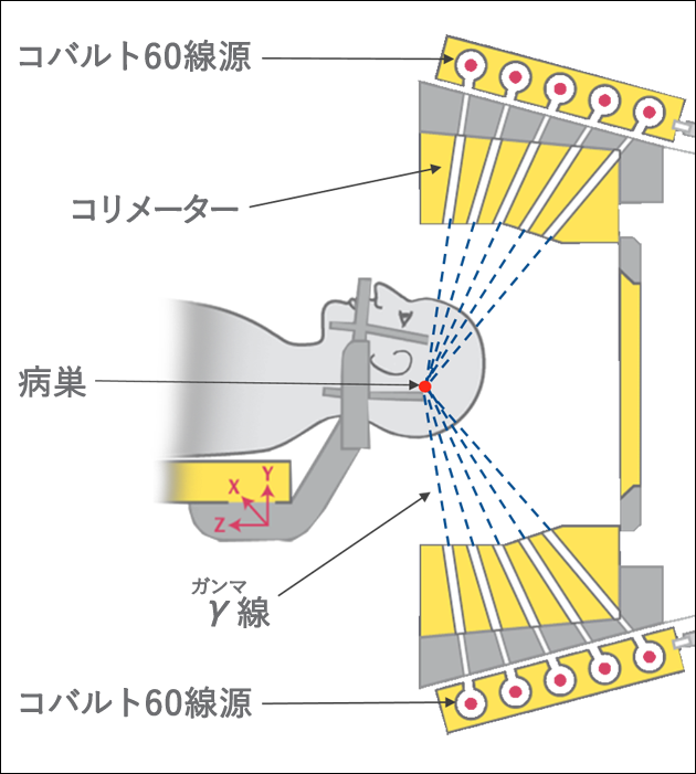 図４　ガンマナイフにおける照射の仕組みの図
