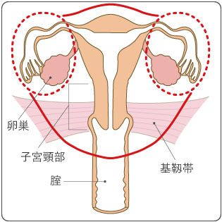 図8 広汎子宮全摘出術の範囲の図