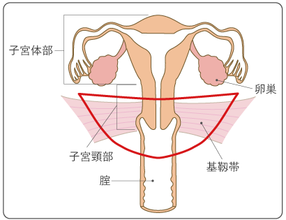 図9 広汎子宮頸部摘出術の範囲の図
